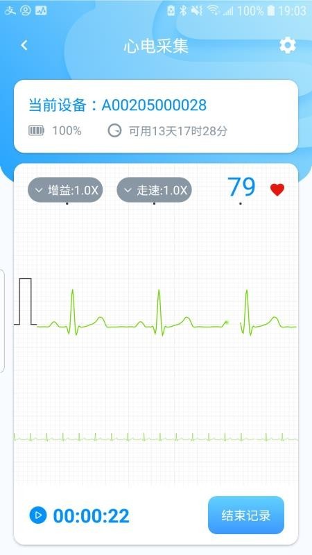 星康心电 v01.00.01.53 官方版图4